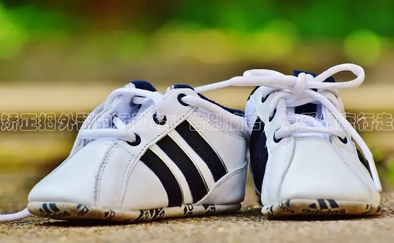 B体育必一官网网易矫正拇外翻的运动鞋：告别痛苦，享受健康行走